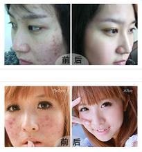 哪里的医院治皮肤病最有效